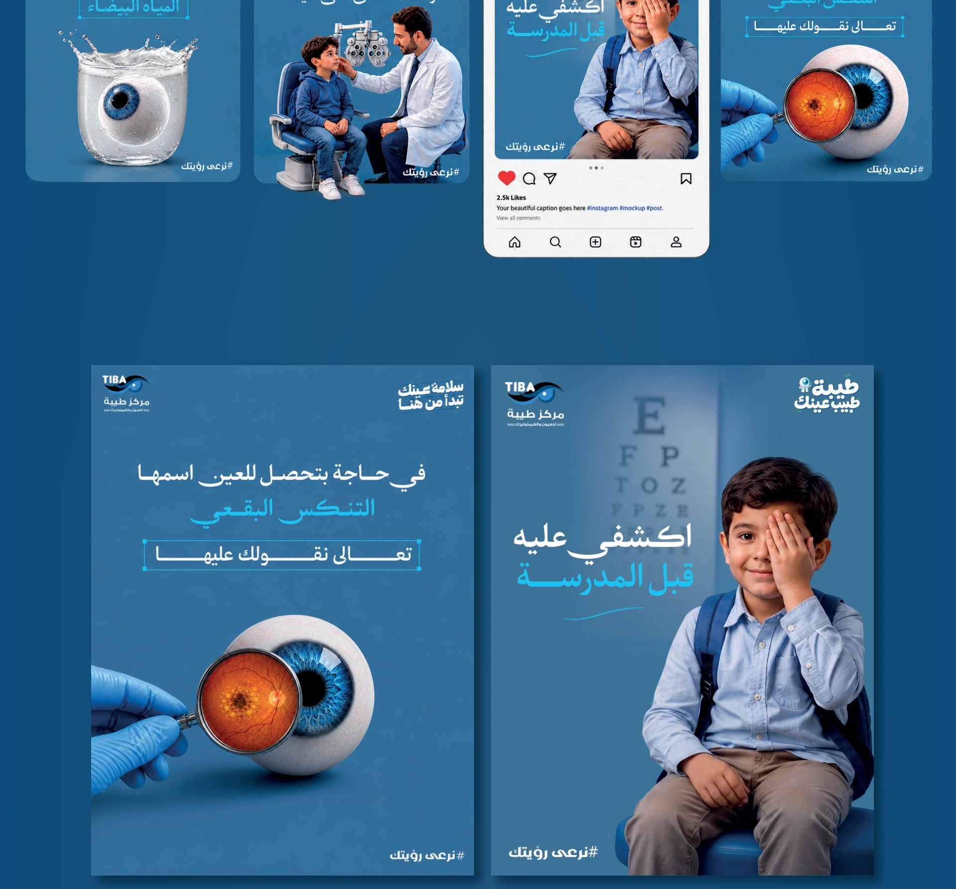 Teba 3